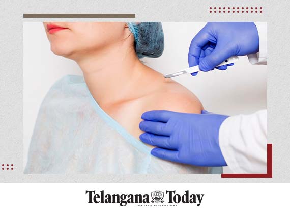 Hyderabad: Reverse shoulder arthroplasty surgery performed on elderly woman