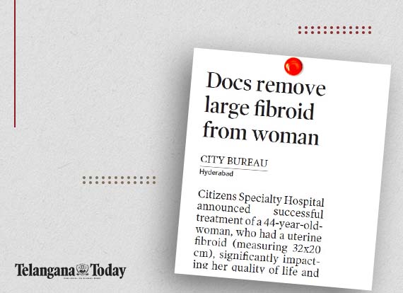  Docs at Citizens Specialty Hospital remove large fibroid