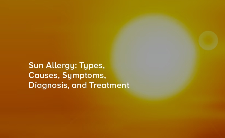 Sun Allergy: Types, Causes, Symptoms, Diagnosis, and Treatment