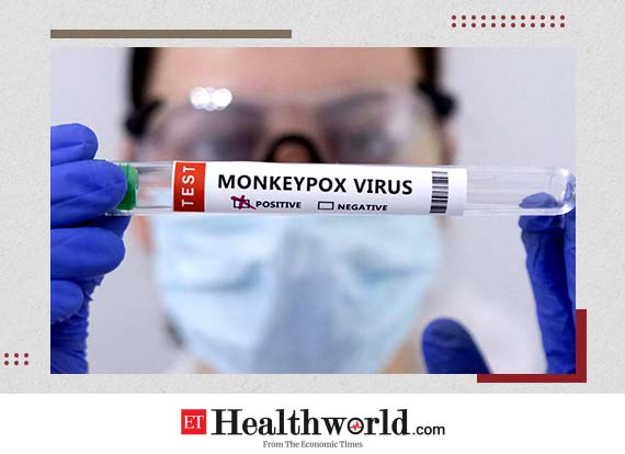 Monkeypox Virus Explained: How contagious is Monkeypox virus and how to prevent