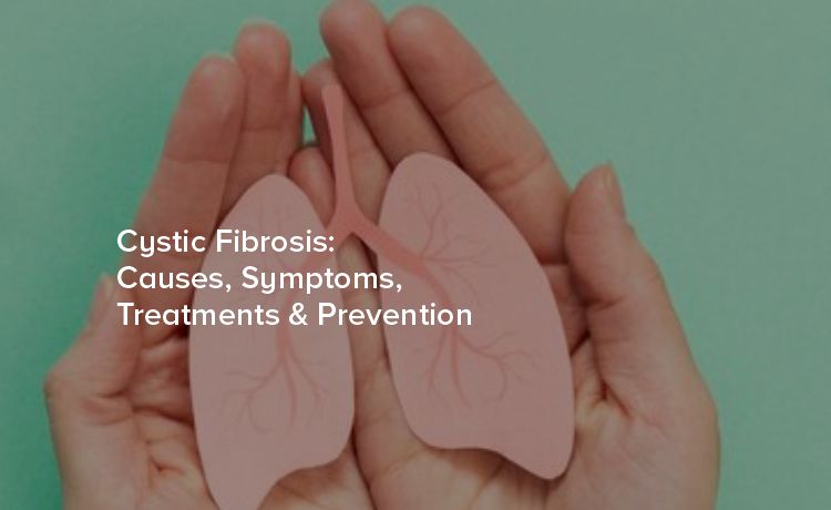 Best pulmonologist in Hyderabad | Cystic Fibrosis: Causes, Symptoms ...