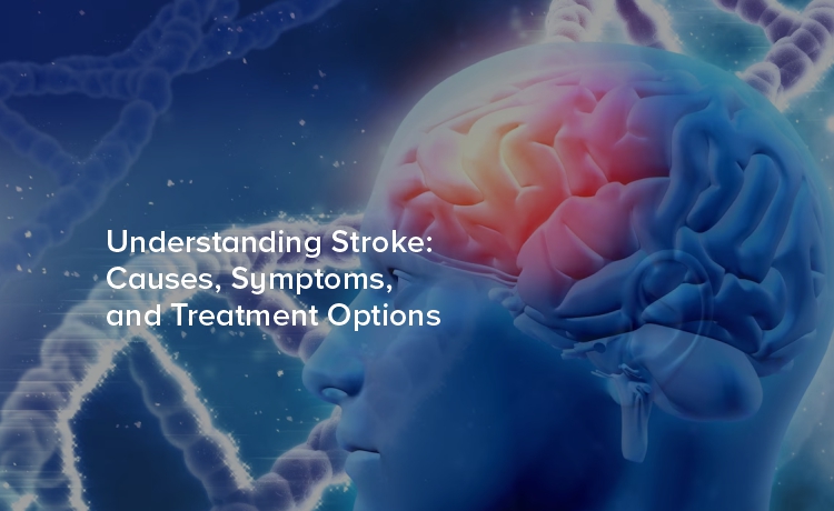 Understanding Stroke: Causes, Symptoms, and Treatment Options