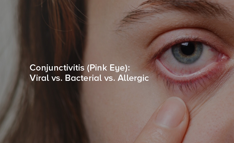 Conjunctivitis (Pink Eye): Viral vs. Bacterial vs. Allergic