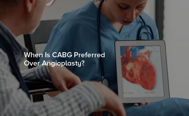 When Is CABG Preferred Over Angioplasty?