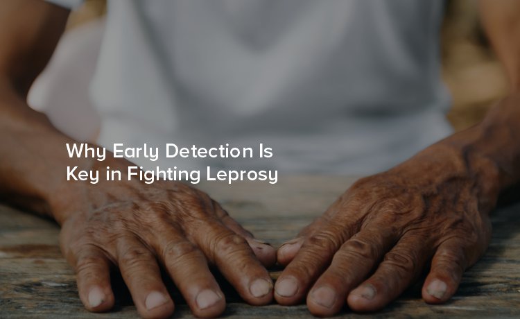 Why Early Detection Is Key in Fighting Leprosy