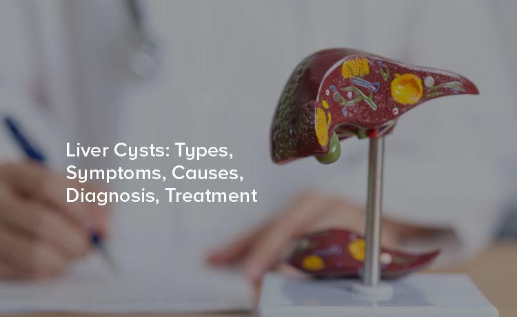 Understanding Liver Cysts: Types, Symptoms, Causes, Diagnosis, and Treatment