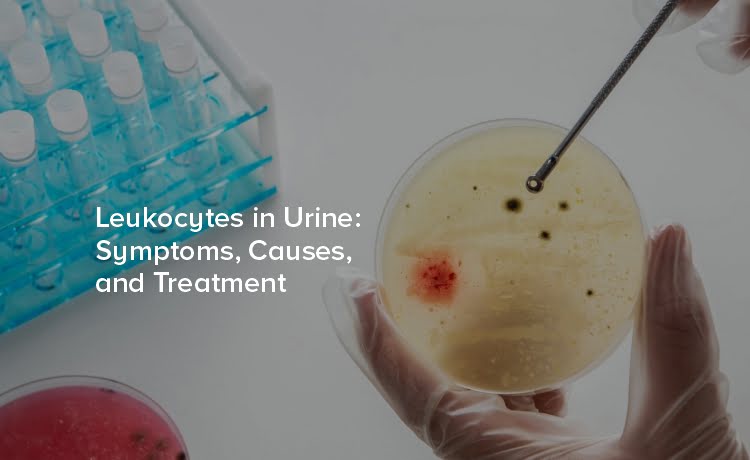 Leukocytes in Urine: Symptoms, Causes, and Treatment