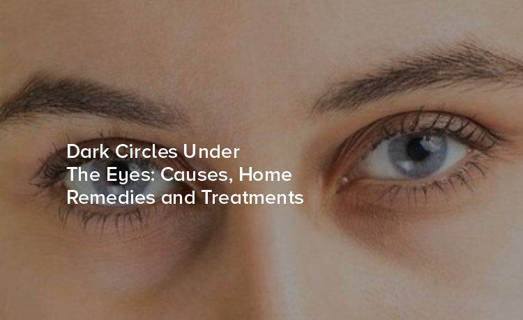 Dark Circles Under the Eyes: Causes, Home Remedies and Treatments